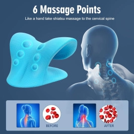 Neck and Shoulder Relaxer for Tmj Pain Relief and Cervical Traction Device for Spine Alignment | Neck Stretcher Chiropractic Pillow for Neck Pain Relief (Blue)