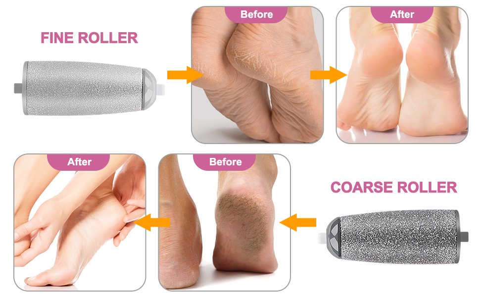 QUIQSHIPPCallusRemoverRechargeablePedicureToolforDeadSkinFootRollerCallusRemover