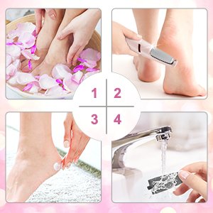 QUIQSHIPPCallusRemoverRechargeablePedicureToolforDeadSkinFootRollerCallusRemover